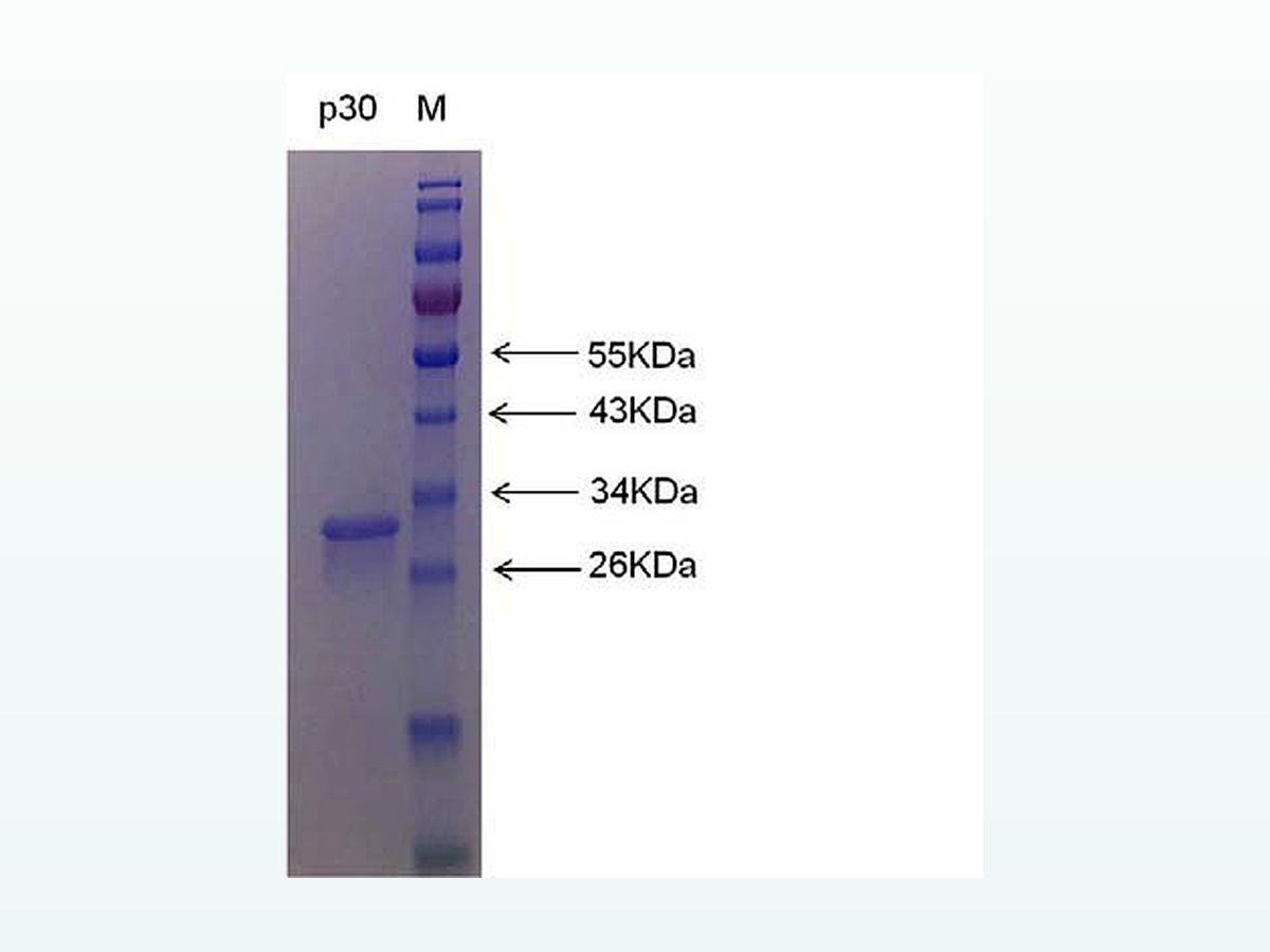 非洲猪瘟病毒VP30重组蛋白 图 2
